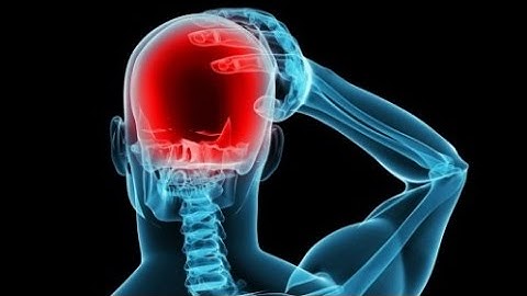Điều Trị Bệnh Đau Nửa Đầu Migraine