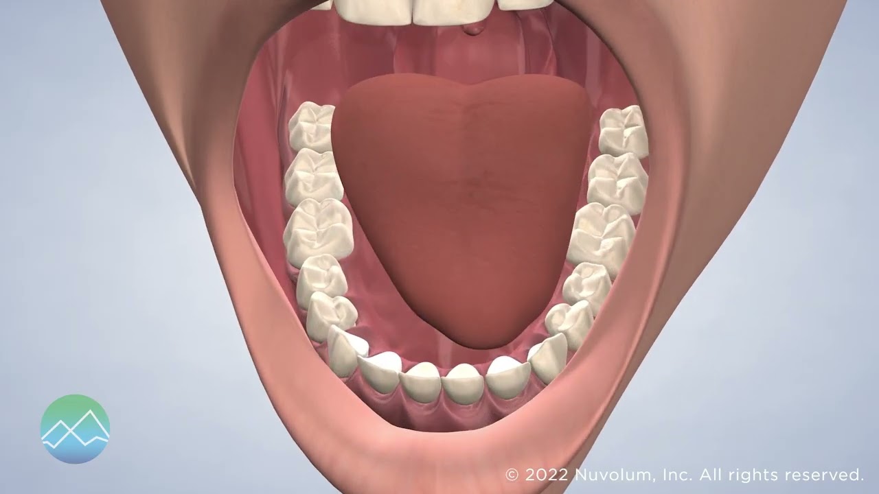 Oral Pathology Kitsap Oral, Maxillofacial & Dental Implant Surgery