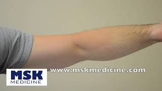 Hook Test - Biceps Tendon Rupture