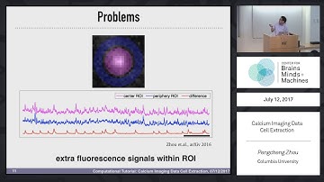 Calcium Imaging Data Cell Extraction