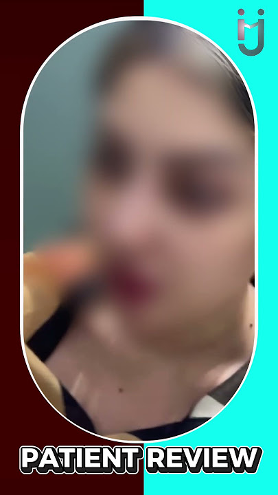 Nose Shaping Patient Review