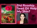 RETIN A, Retinol vs. ROSEHIPS Seed oil, YOUTHFUL skin & Anti-Aging.