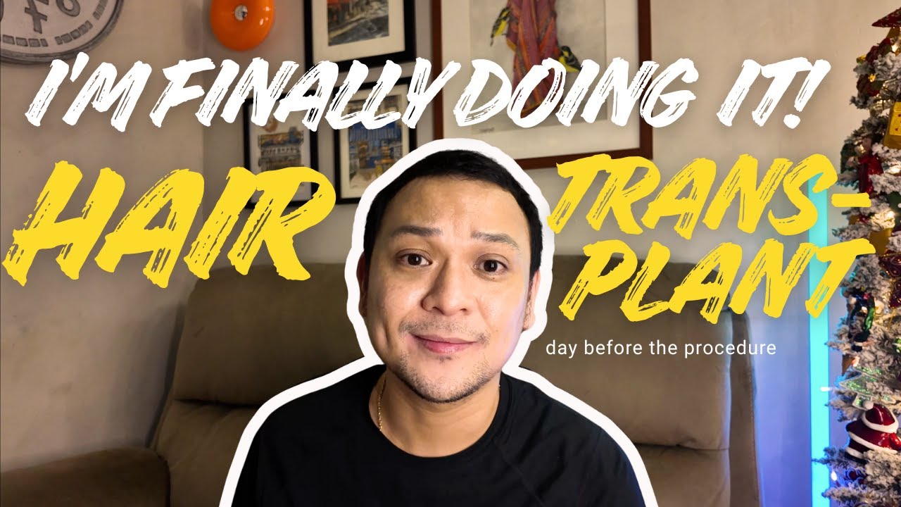 Why I’m Finally Getting a Hair Transplant | My Honest Story: EP1