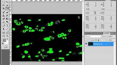 034 Visualization Colocalization Co Existence Confocal Images