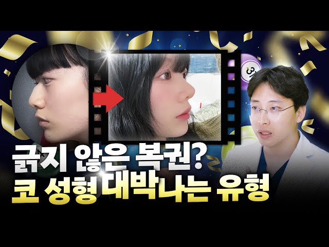 💁‍♀️코 성형 대박나는 5가지 유형 😳혹시 나도? 하시는 분 필수 시청! | #성형 #코성형 #매부리코