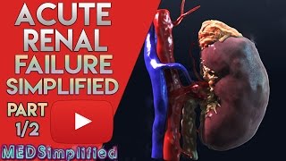 Acute kidney Failure Made Easy- Part 1/2