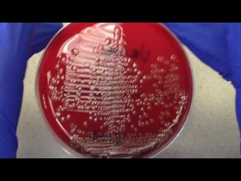 Video: Bakteriell Urinkultur: Hur Man Donerar, Insamlingsregler, Förberedelse För Analys