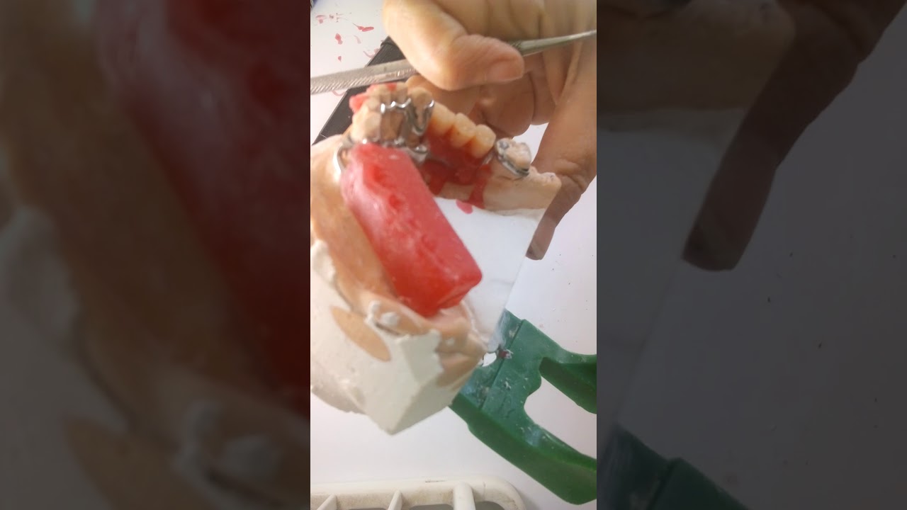 Vídeo 3 - montagem de ppr