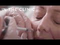 First-Time Botox and Fillers in late 50s | In the Clinic: Before and Afters | Fiona