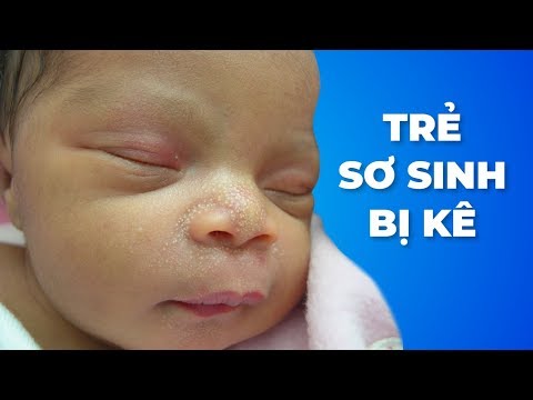 Trẻ sơ sinh bị kê tắm lá gì cho nhanh khỏi sau 2-3 ngày?