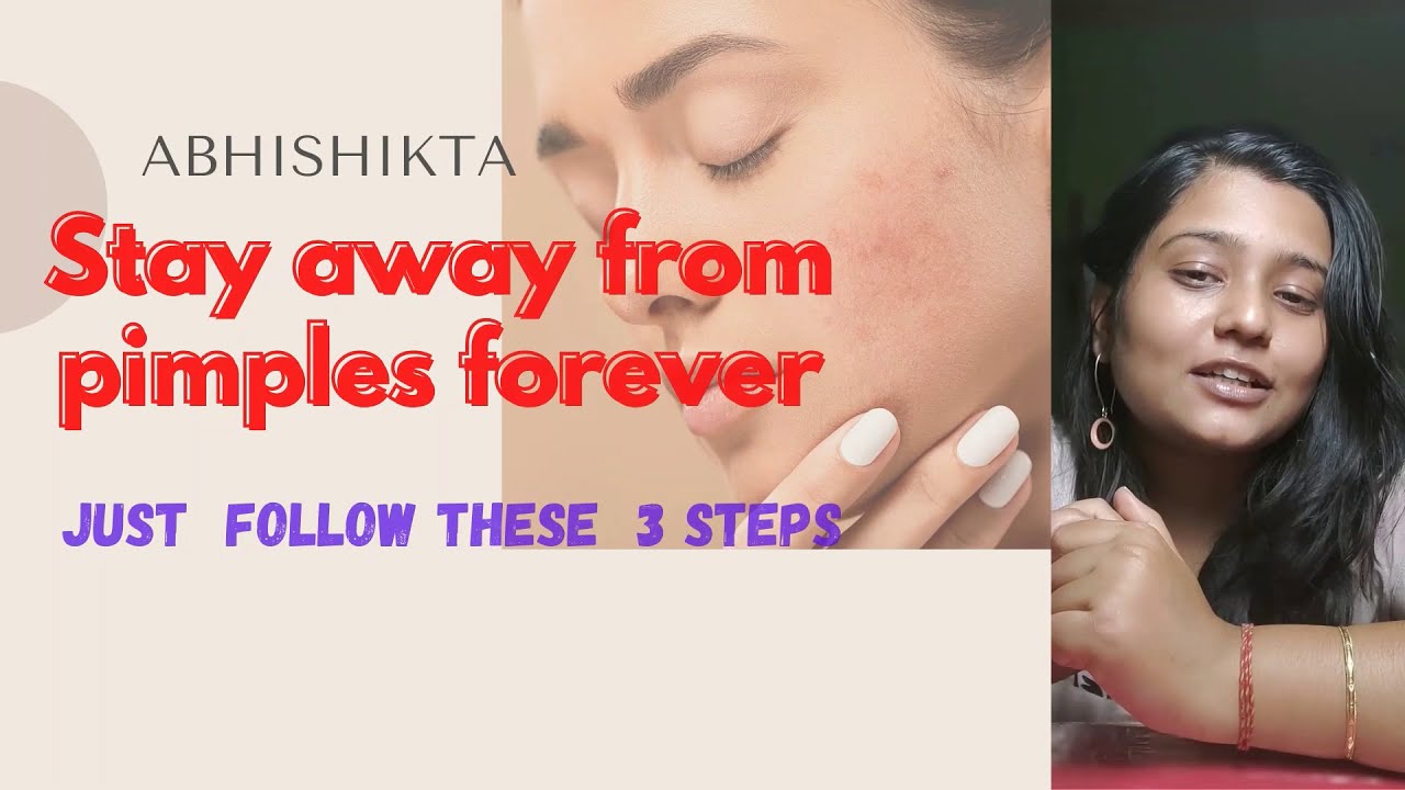 How To Stay Away From Acne Prevent Pimples No More Acnes Simple Steps Youtube youtube