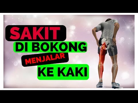 Hanya 1-2 Hari Sakit Pinggang Sembuh Total l Cara Menyembuhkan Nyeri Pinggang Secara Alami. 