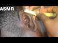 ASMR NIT-PICKING |relaxing Razor shave,Close-up | shaving my husband&#39;s ear