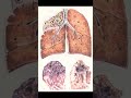 Туберкулёз , микробиология
