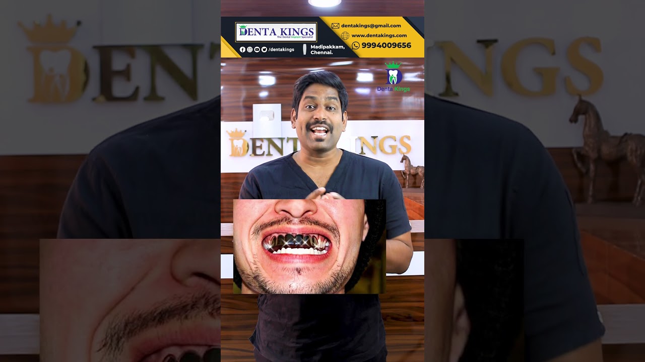 Types of Dental Crowns. பல் கேபின் வகைகள் மற்றும் பயன்பாடுகள் Denta Kings Tamil