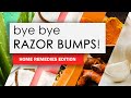 6 Home Remedies To Get Rid Of Razor Bumps Fast! - Natural Ingredients