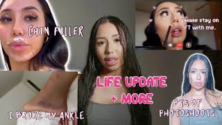CHIN FILLER, BTS PHOTOSHOOTS, LIFE UPDATE &amp; MORE!!