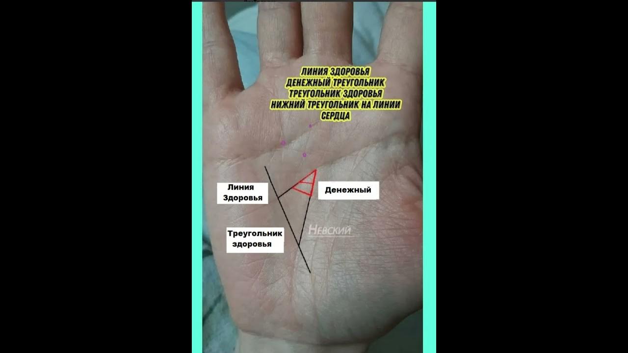 хиромантия денежный треугольник. хиромантия треугольник на линии судьбы. хиромантия денежный треугольник. треугольник на руке хиромантия. денежный треугольник на линии жизни.