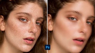 Remove Pimples in Photoshop - Photoshop Tutorial