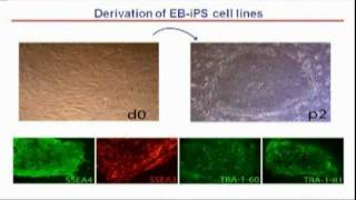 Epidermolysis Bullosa: Corrected iPS Stem Cell-Based Therapy