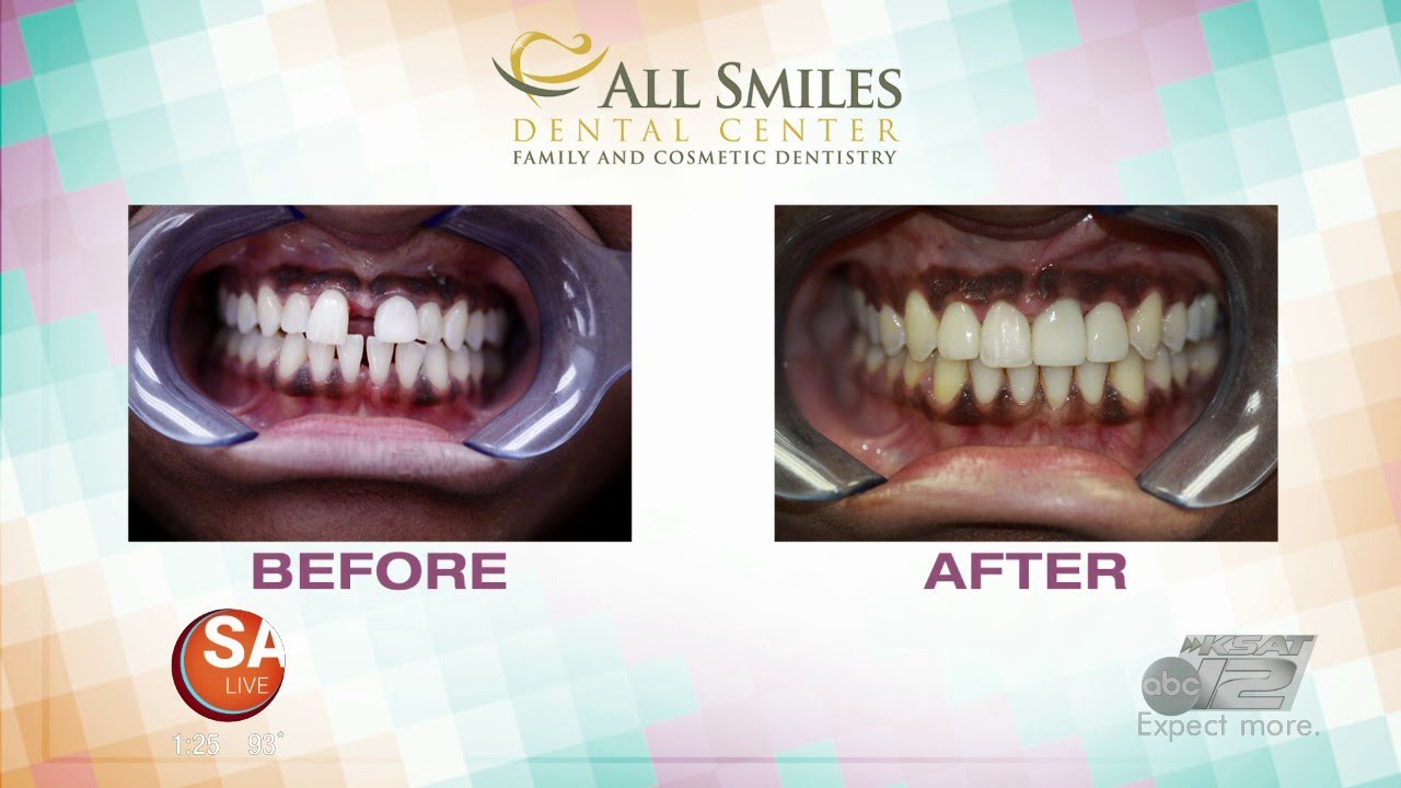 Get the perfect smile you've always wanted