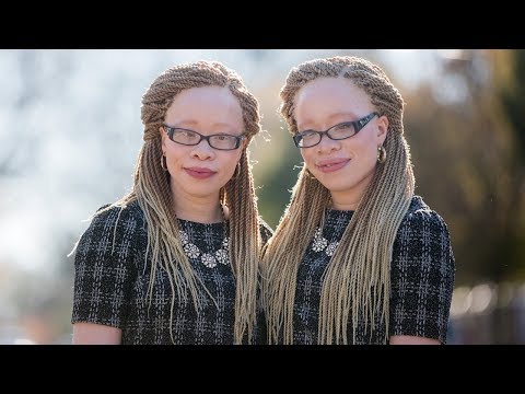 Twins With Albinism Wear Their Condition With Style | SHAKE MY BEAUTY
