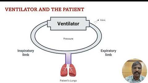Mechanical Ventilator