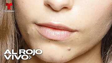 ¿Cómo levantar el labio de arriba?