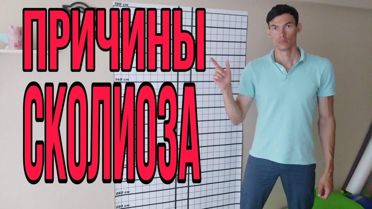 ЧТО ВЫ НЕ ЗНАЛИ О СКОЛИОЗЕ