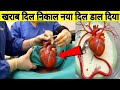 देखिए दिल का ट्रांसप्लांट कैसे होता है | How does heart transplant surgery work?
