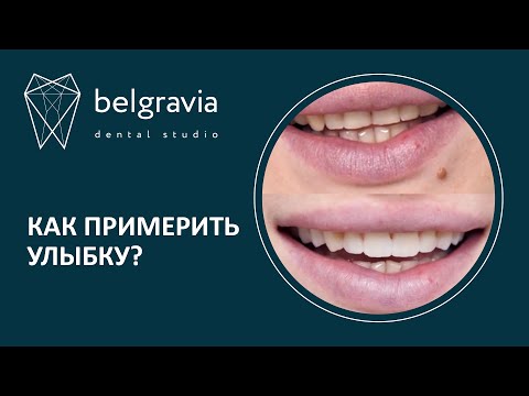 🤩 Как примерить улыбку?