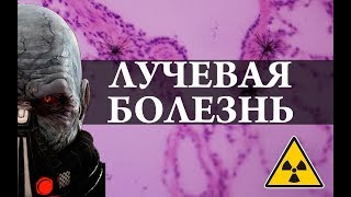 Лучевая Болезнь. Радиация. Химия – Просто