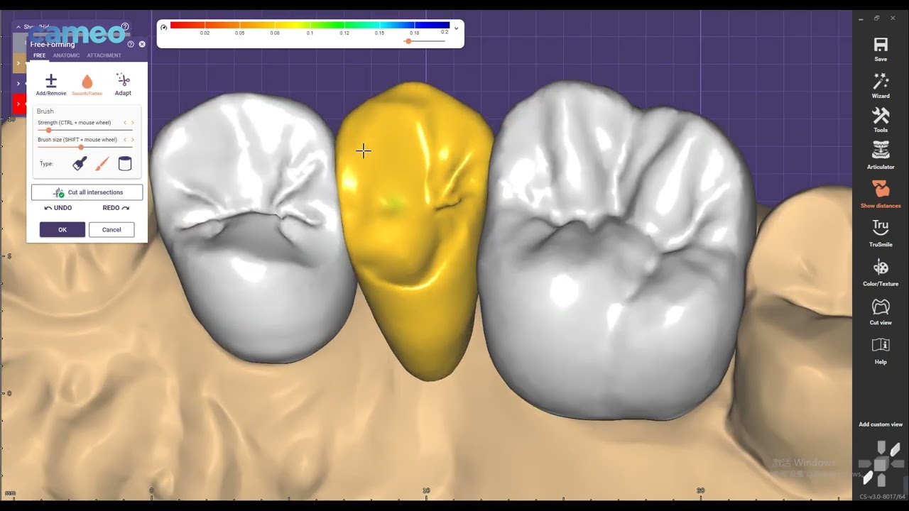 Aidite Exocad design guide: Posterior bridge design