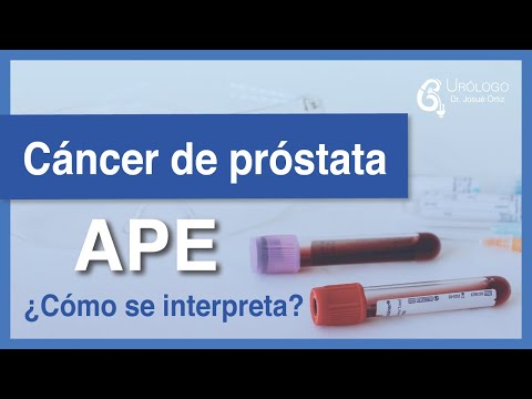 Cáncer de próstata - APE (Antígeno Prostático Específico) ¿Cómo interpretarlo?│URÓLOGO Josué Ortiz