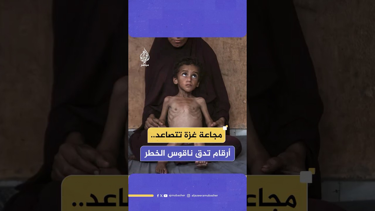 المجاعة في غزة تتفاقم.. وتحذيرات من موت جماعي ينتظر 100 ألف طفل جراء سوء التغذية