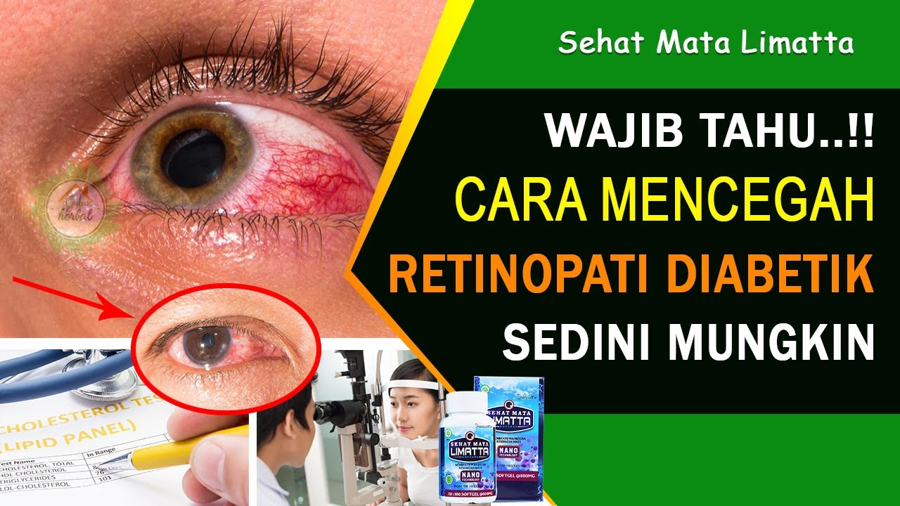 Cara Mencegah Retinopati Diabetik (Mata Diabetes) - Sehat Mata Limatta