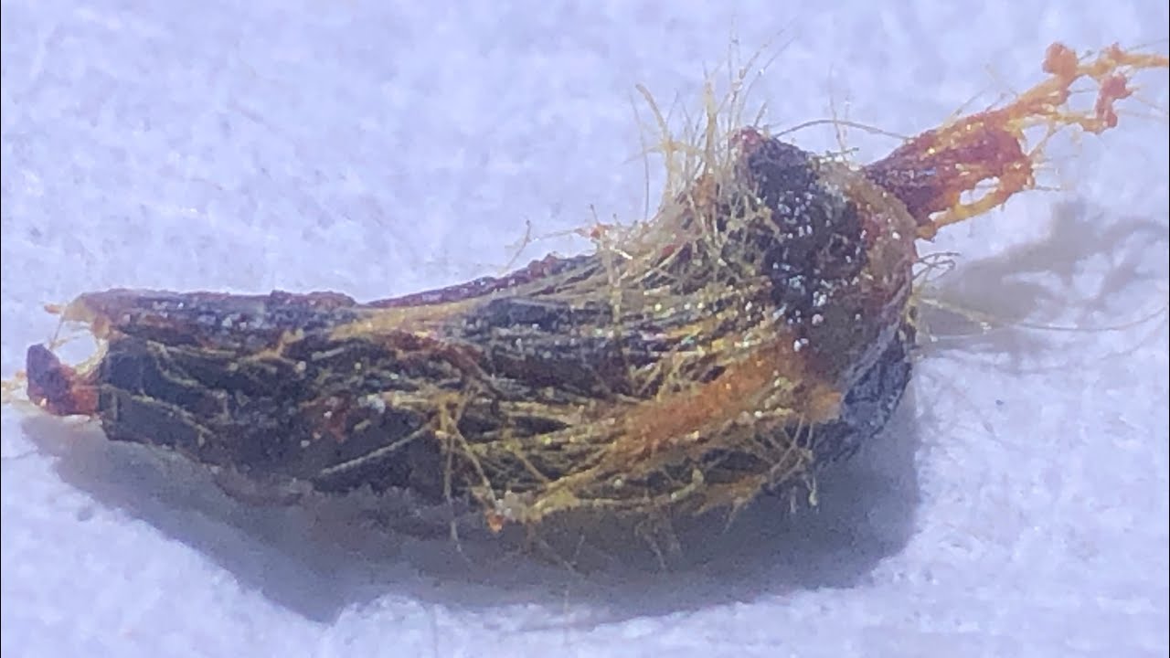 873 Matted Sticky Ear Wax Removal YouTube