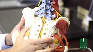 Turned Away by Other Spine Surgeons | Complex Revision Surgery | Long Island Spine Specialists
