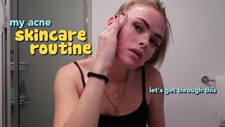 my skincare routine for acne :p (vlogmas episode 3)