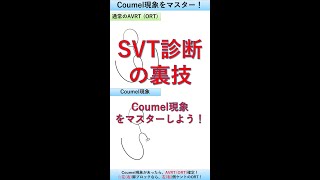 【SVT診断の裏技】Coumel現象をマスターしよう！ #shorts