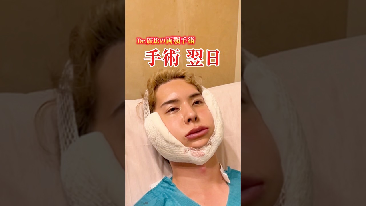 【骨切り】両顎手術を受けた男性にインタビュー！#骨切り #両顎手術 #ダウンタイム #美容整形