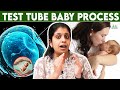 Test Tube Baby Treatment Tamil | Dr Deepthi Jammi,Cwc | IVF procedure , infertility, fertility