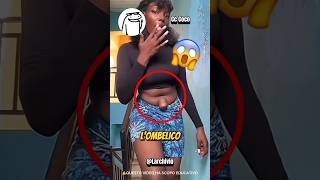 Se Ti Svegli Con Lombelico Così, Chiama Subito Un Dottore