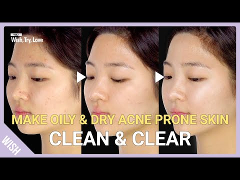  Essentials for Oily, Dry Acne Prone Skin! How to Get Clear Skin at Home | Wish, Try, Love