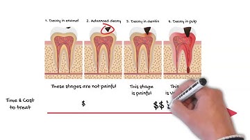 What happens if you leave a cavity untreated?