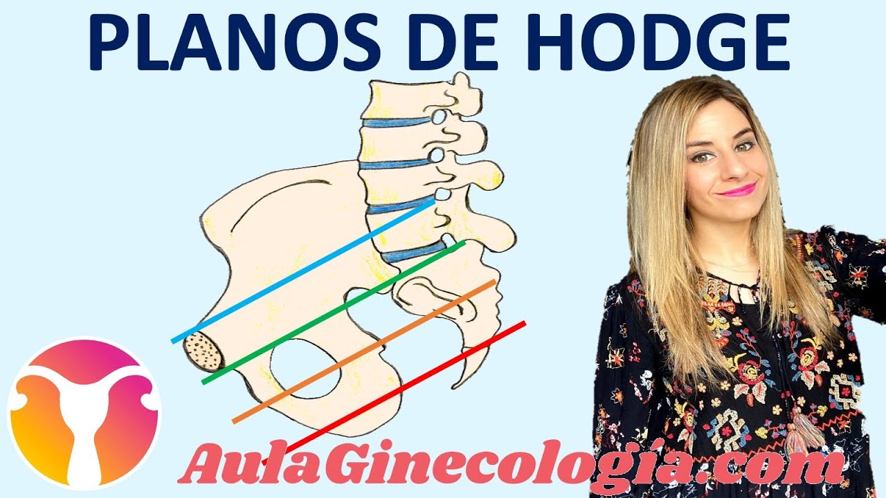 PLANOS DE HODGE para definir la ALTURA de la PRESENTACIÓN en el PARTO. Ginecología y PLANOS DE HODGE para definir la ALTURA de la PRESENTACIÓN en el PARTO. Ginecología y