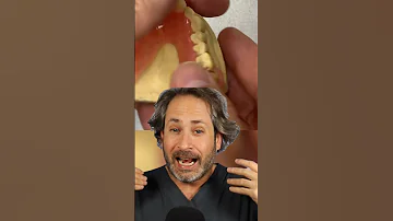 ¿Cuáles son las desventajas de las prótesis dentales?