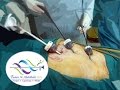 د. تامرعبدالباقي - جراحات الفتق بالمنظار  Totally Extraperitoneal Hernia - Tamer Abdelbaki MD