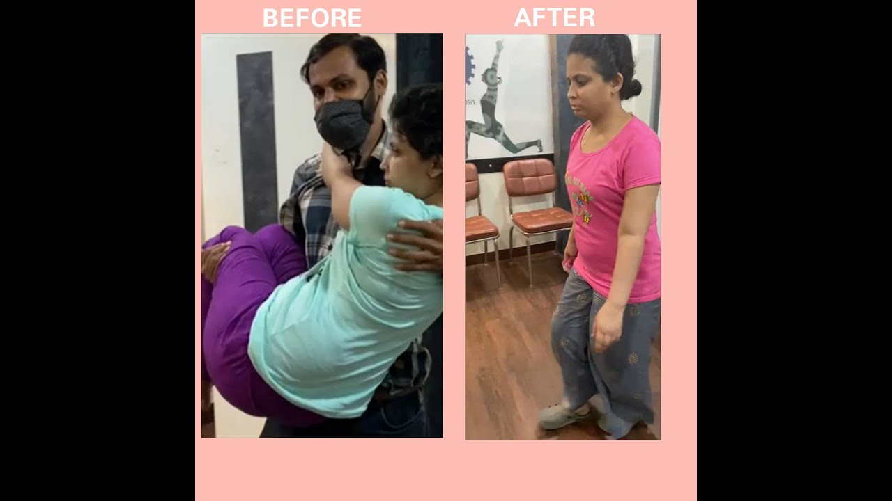 one year bedridden patient started walking independently within 3 weeks