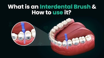 What is an Interdental Brush and How to use it? - 3D Step by Step Guide